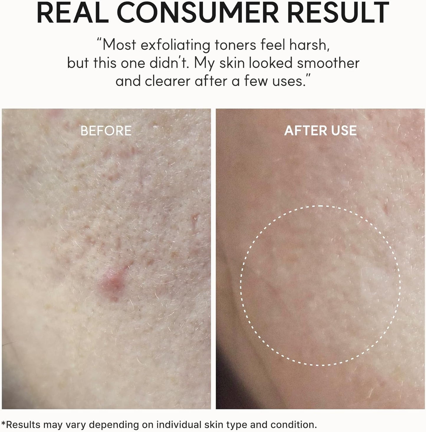 Arencia - Eraser Shot Glycolic Acid 10% Exfoliator + BHA Exfoliating Toner, AHA Liquid Exfoliant (200ml)