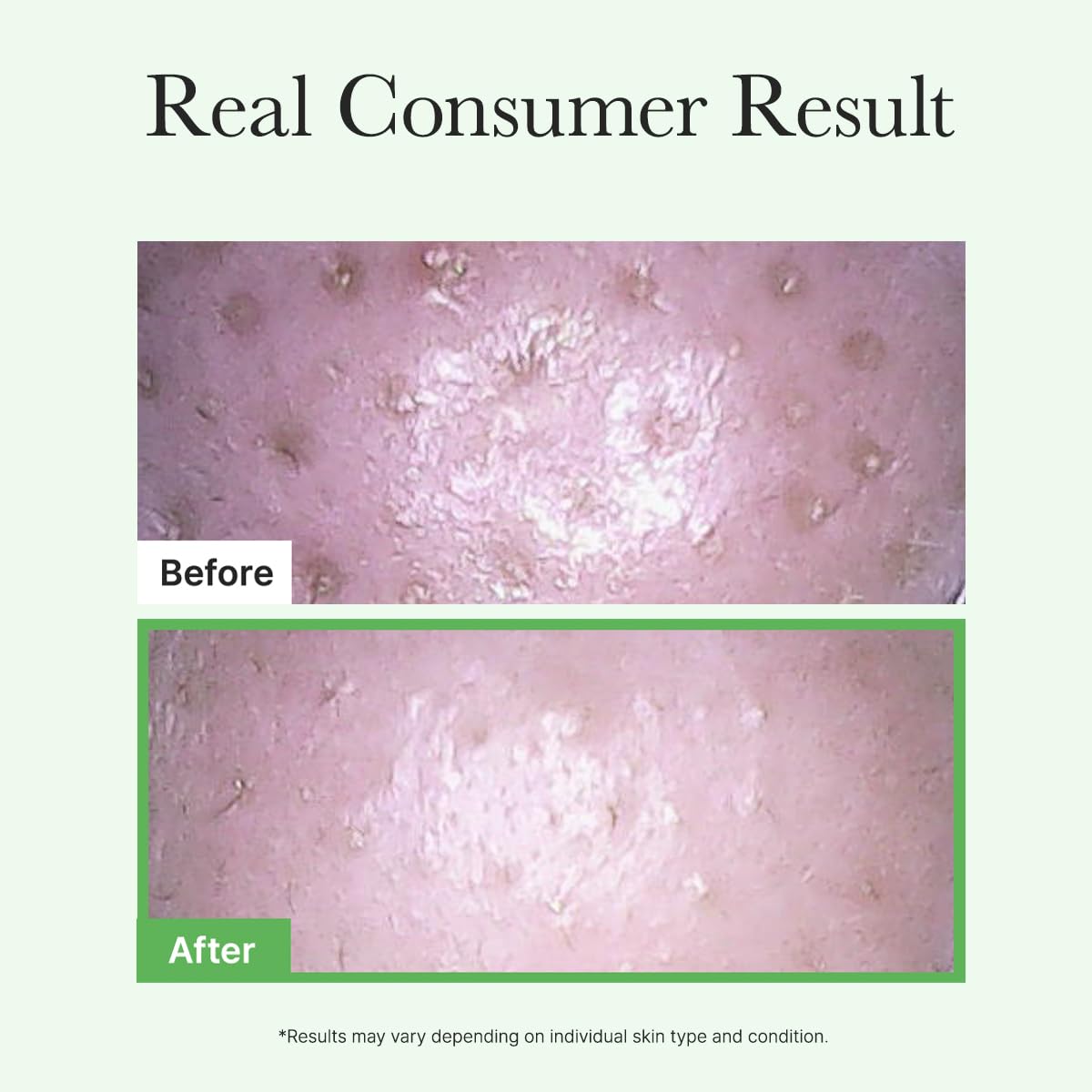 Arencia - Pore Melt Mochi Cleansing Oil (200ml)