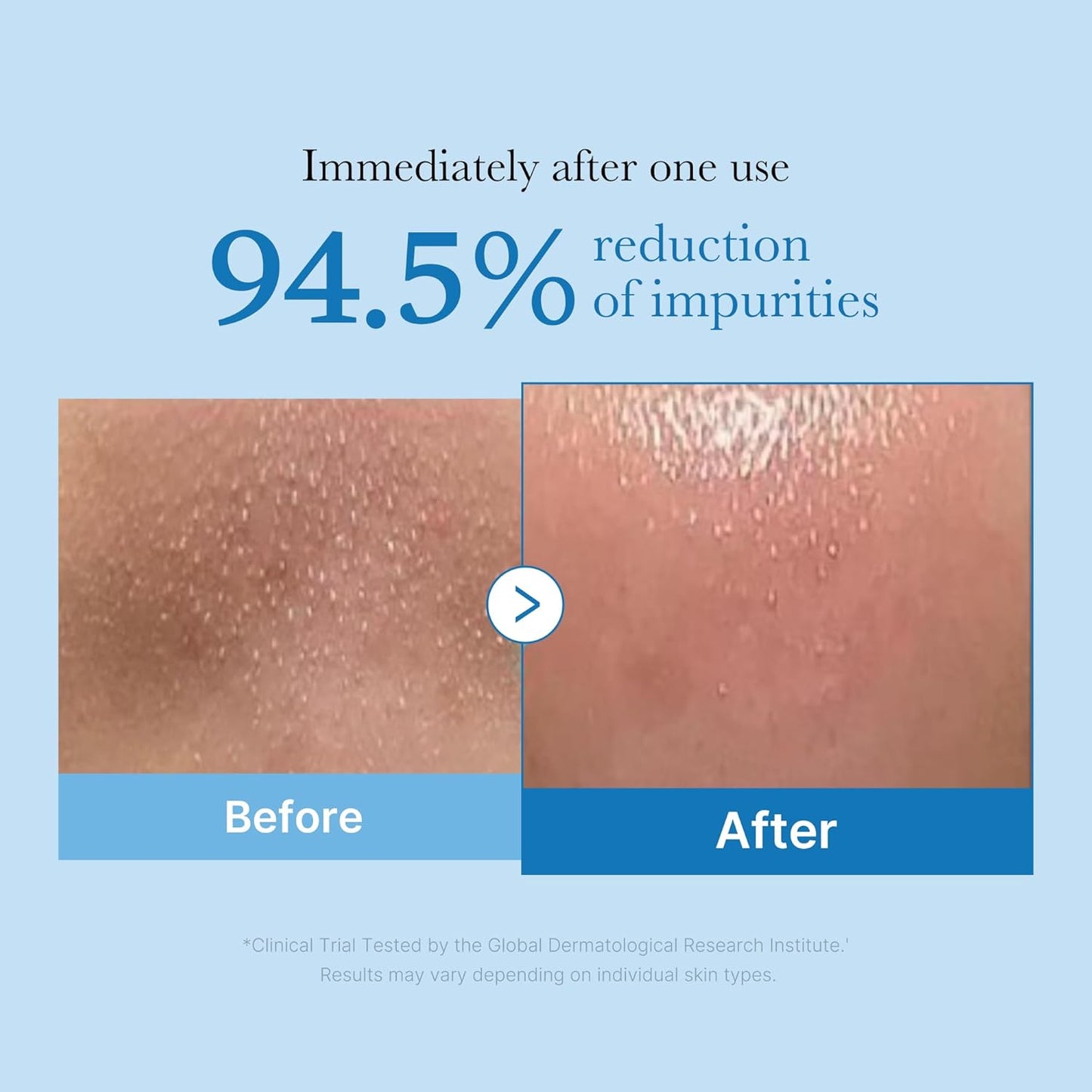 Medicube - Zero Pore Blackhead Deep Cleansing Oil (205ml)